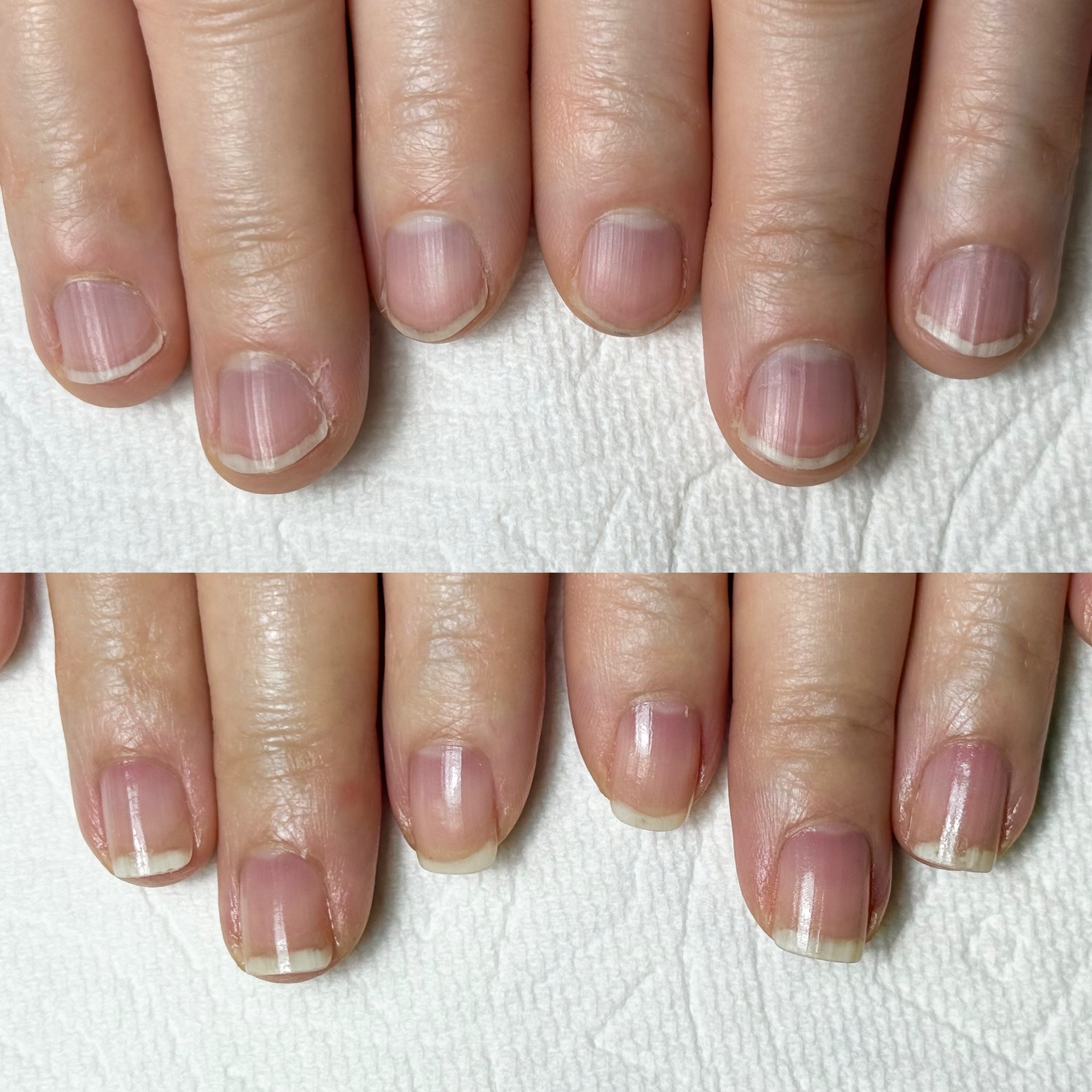 carelabo.T-nail