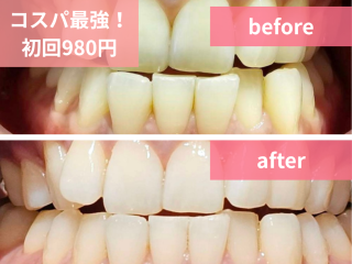 BODY ARCHI 松山店